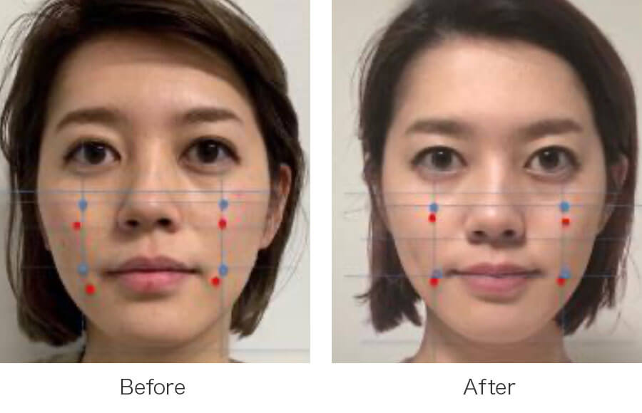 フェイスポインター FACE-POINTER ( フェイスポインター ) - 【COREFIT ...