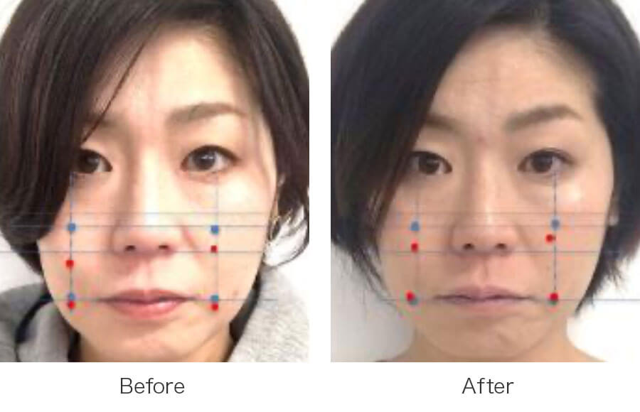 フェイスポインター FACE-POINTER ( フェイスポインター ) - 【COREFIT ...