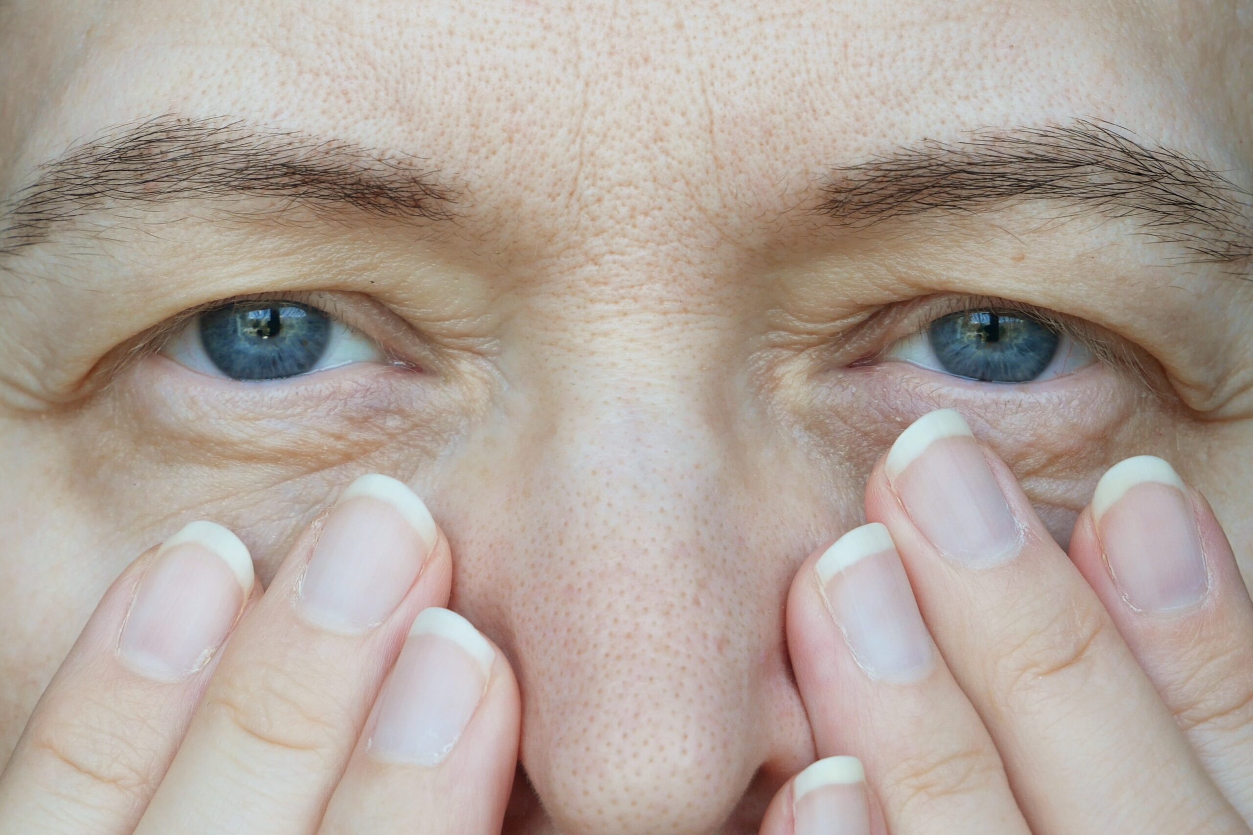 眼瞼下垂（がんけんかすい）手術とは？原因や治す方法について解説-1