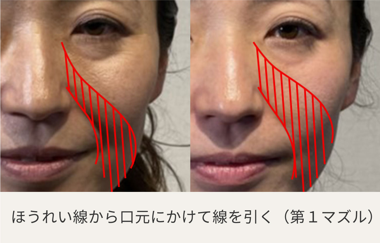 コアフィット　フェイスプレイヤー FACE PLAYER – COREFIT