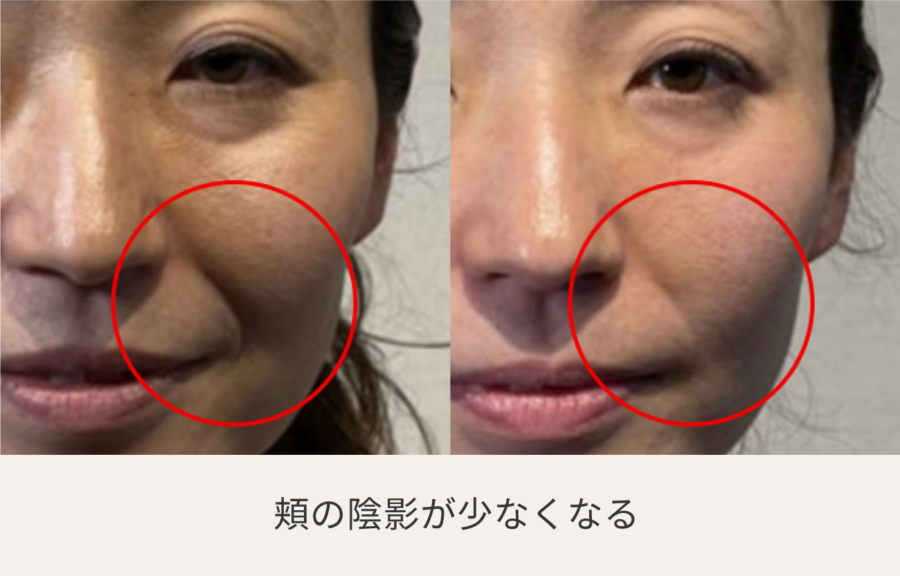 コアフィット フェイスプレイヤー FACE PLAYER – COREFIT