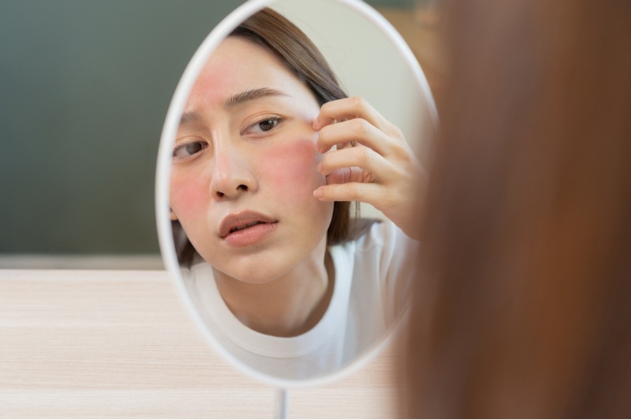 花粉症による美容リスクを解説！肌荒れ対策やスキンケアのポイントは？-4