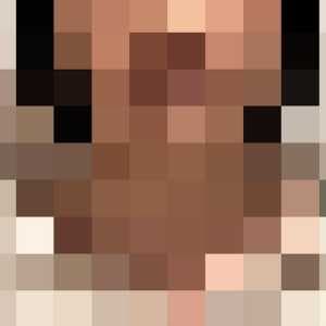 でっぱり頭タイプ