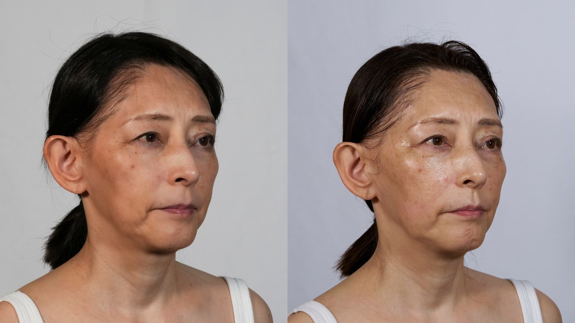 COREFIT 成形顔づくりセット The HORiZONE – COREFIT