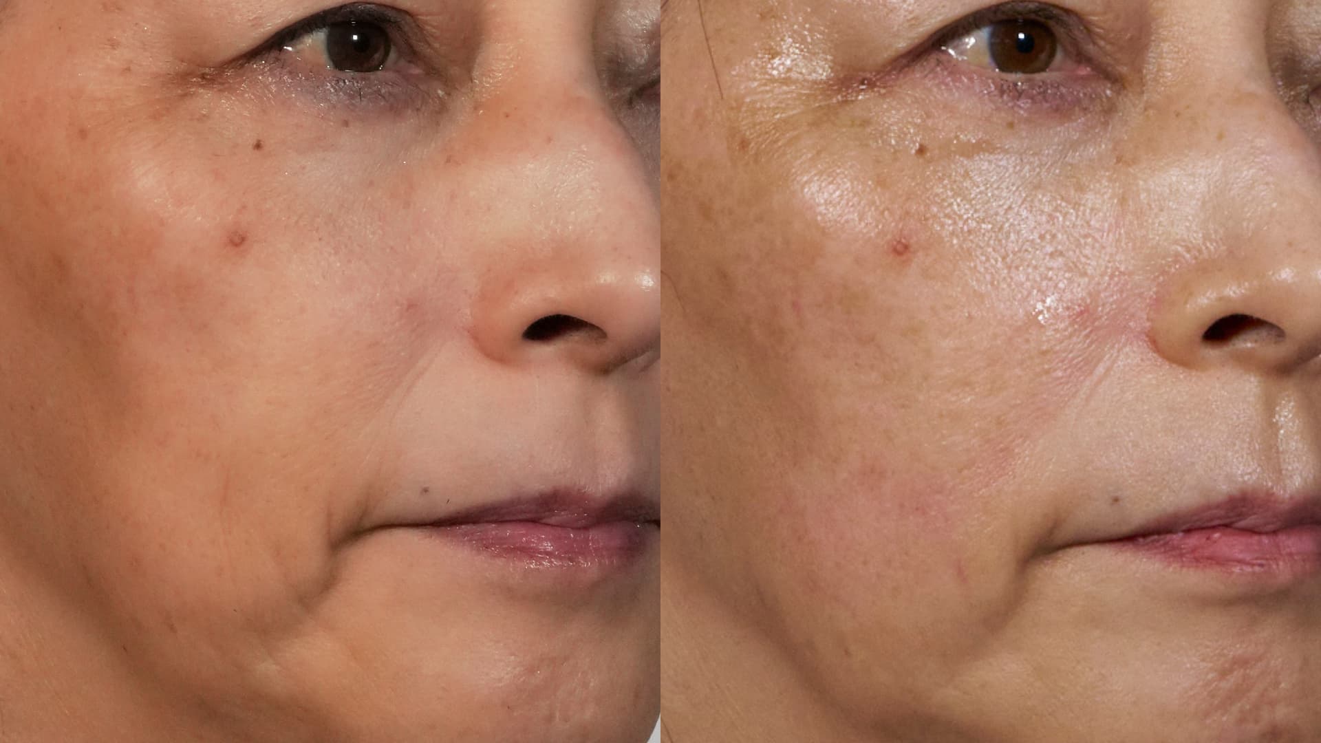 The HORiZONE_lp_ba (5)