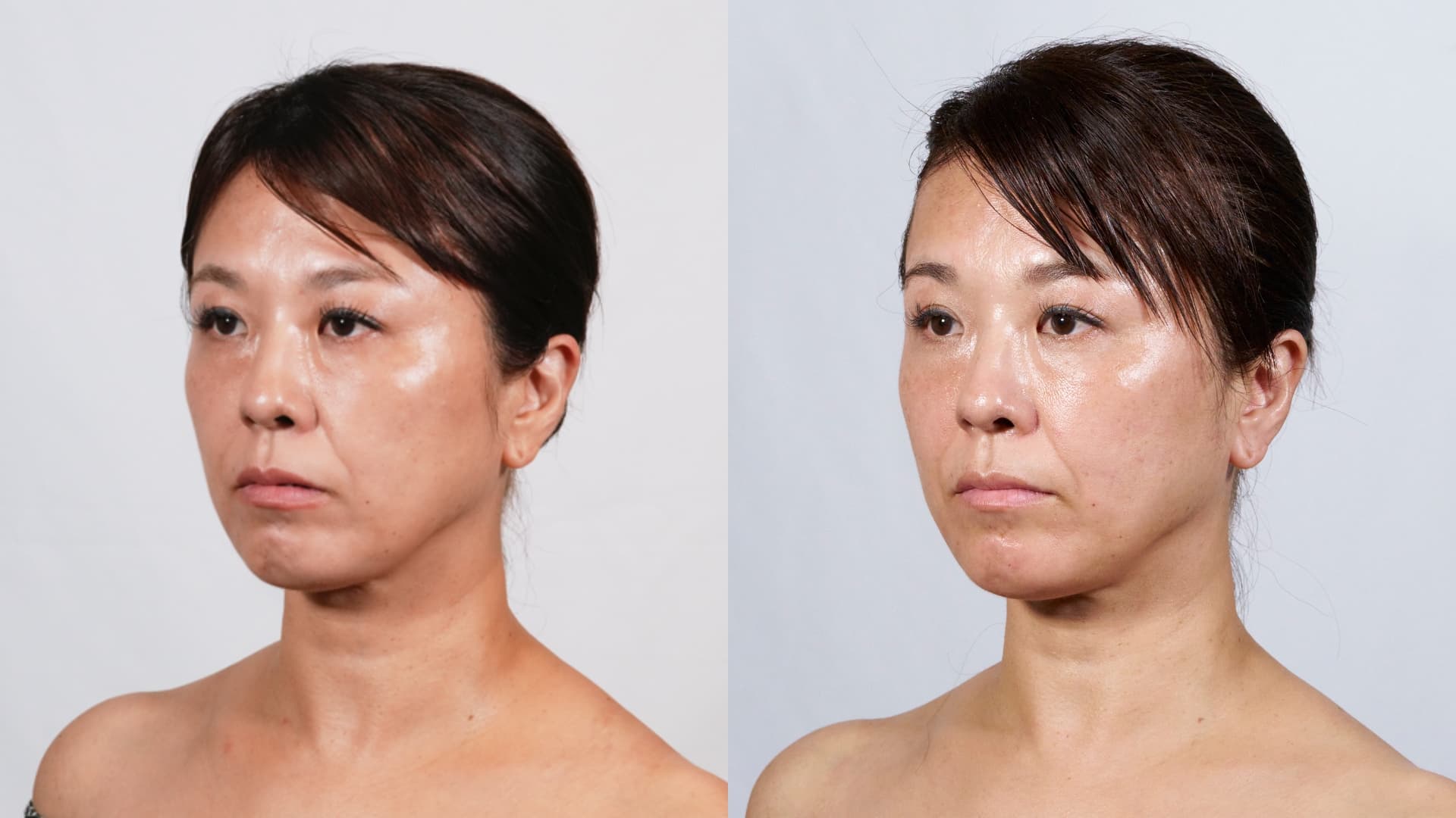 The HORiZONE_lp_ba1 (1)