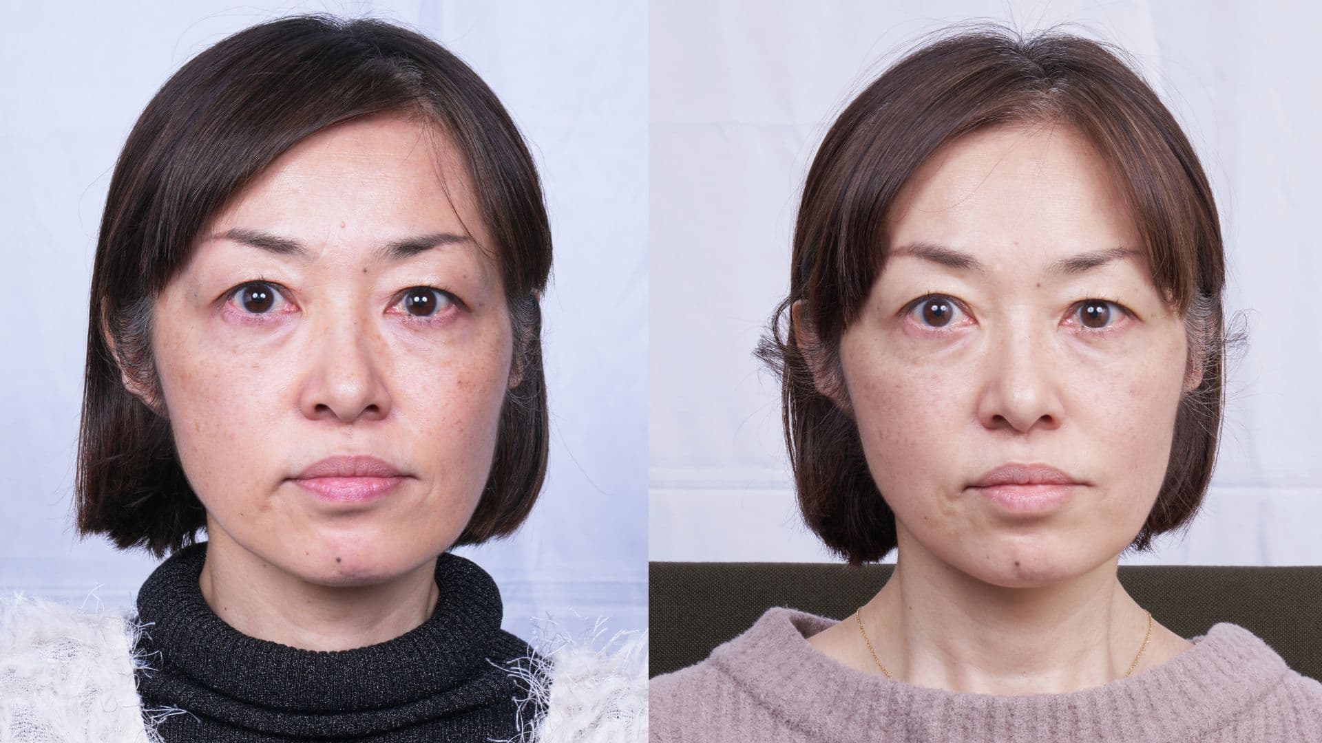 The HORiZONE_ba_s (1)