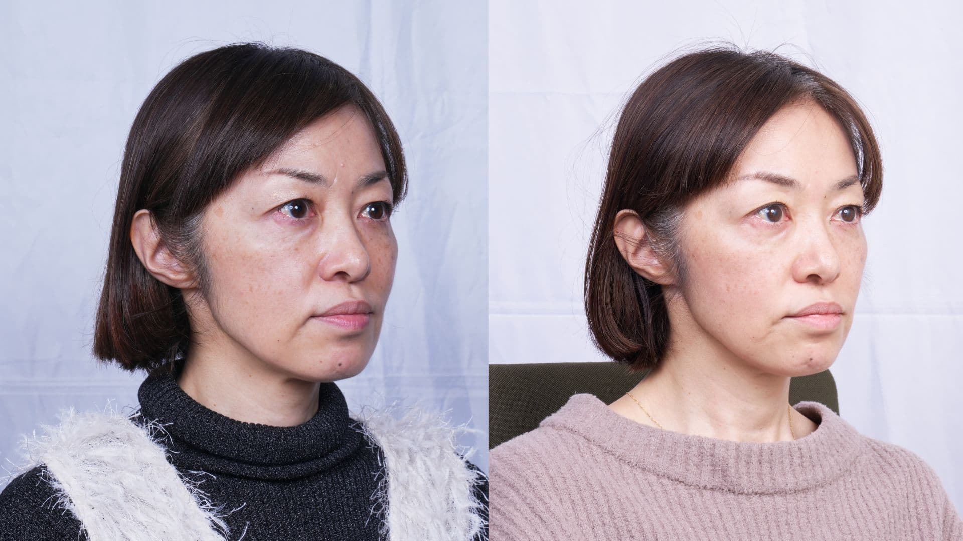 The HORiZONE_ba_s (2)