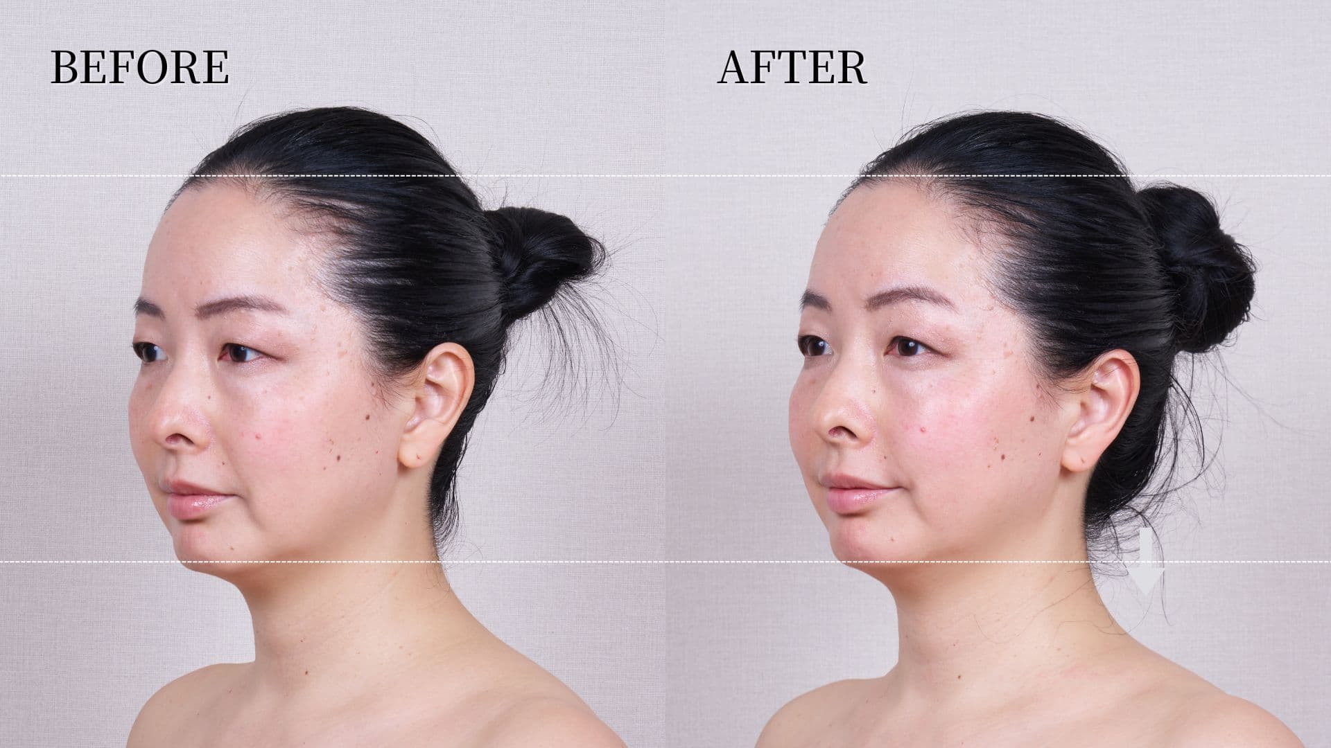 TheVOLCAiNO_rensyaBA (3)