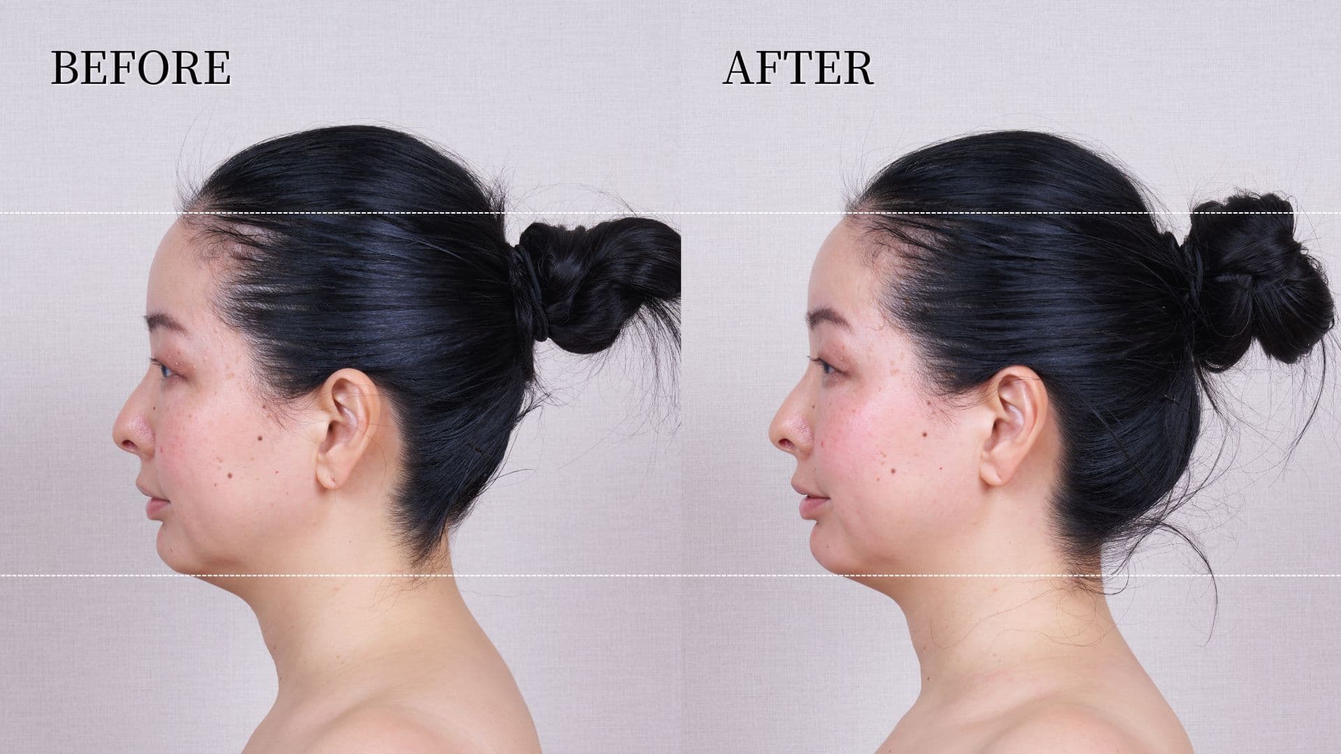 TheVOLCAiNO_rensyaBA (4)