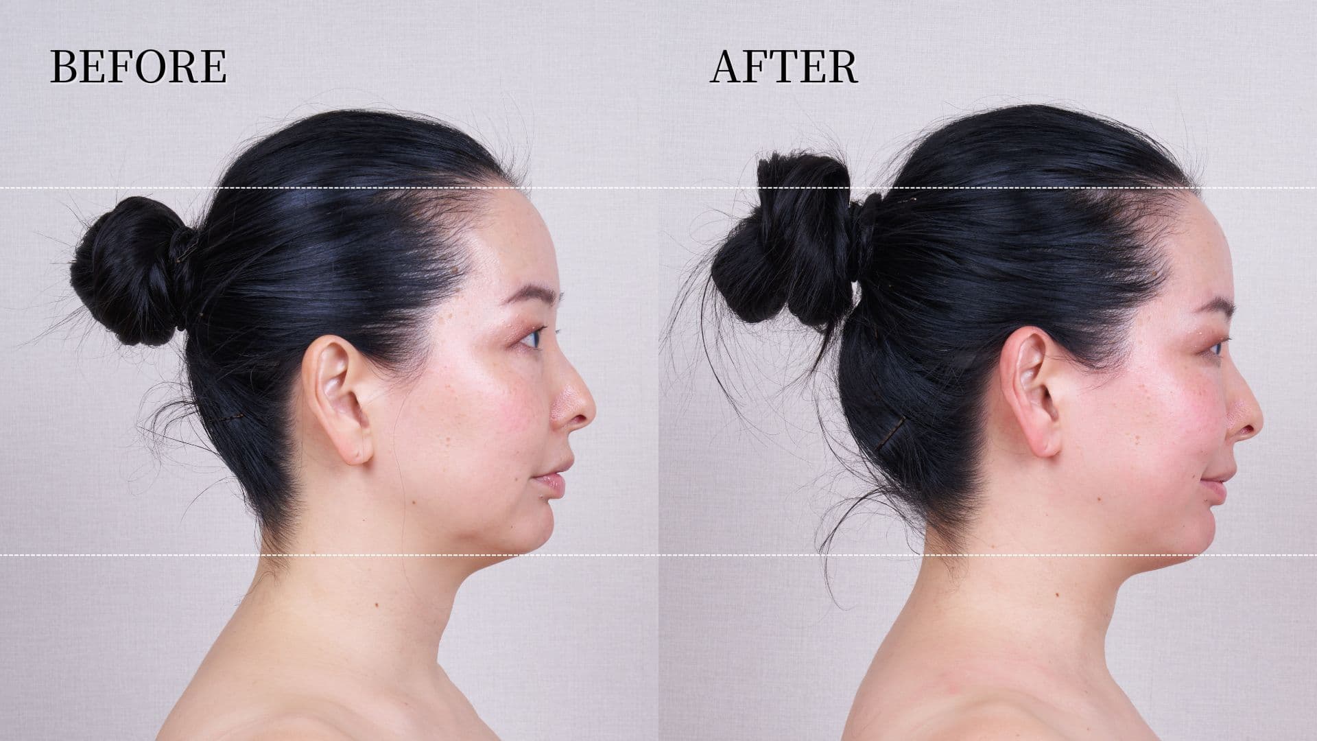 TheVOLCAiNO_rensyaBA (6)